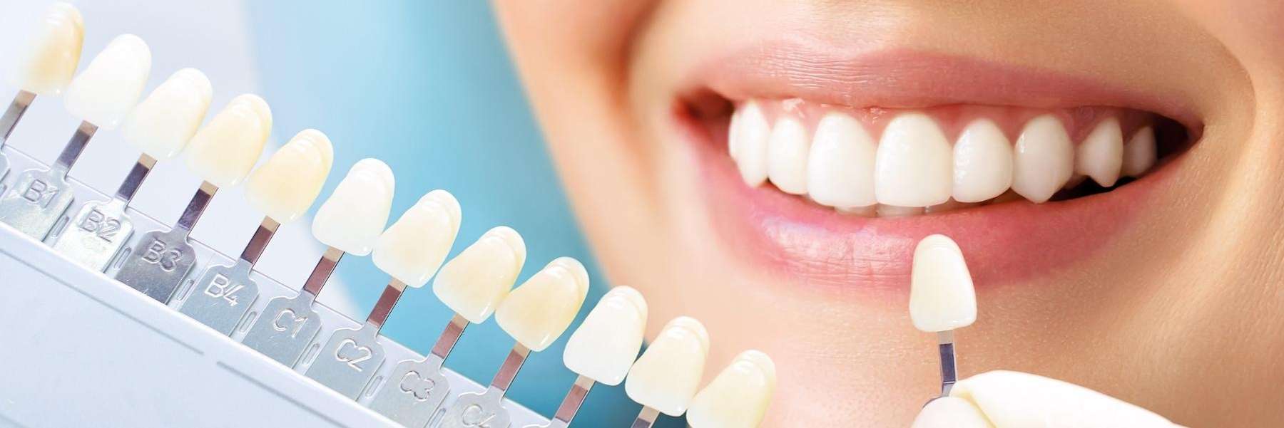 teeth color shades in Urbandale, IA
