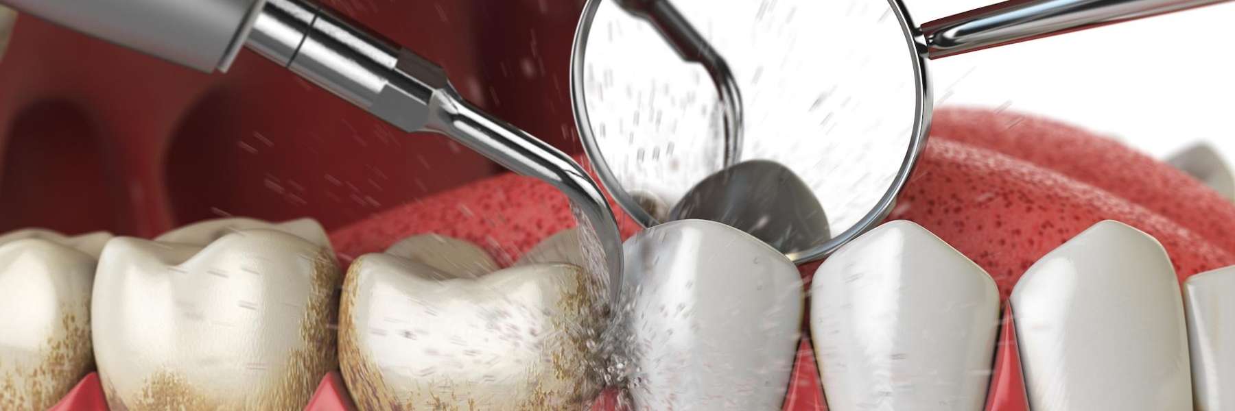 deep cleaning in johnston ia