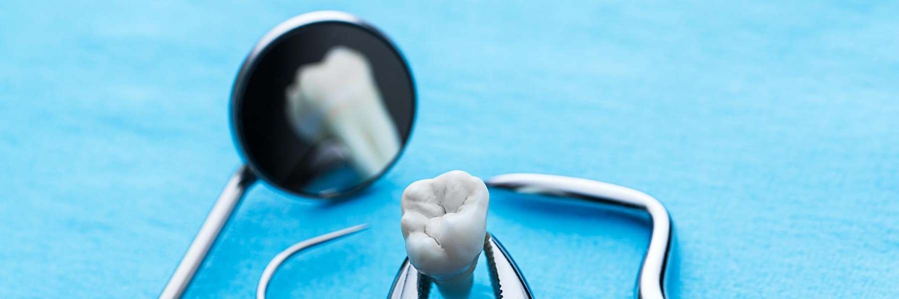 tooth extracted in Urbandale IA